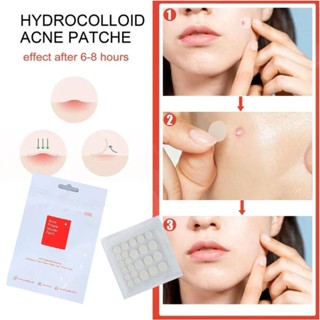 แผ่นสติกเกอร์ รักษารอยแผลเป็น รอยแผลเป็นจากสิว จํานวน 24 แผ่…