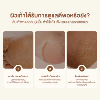 เครื่องขัดส้นเท้าไฟฟ้า USBชาร์จ Electric Foot Grinder เครื่องบดเท้าไฟฟ้า พกพาได้ ขัดเซลล์ผิวที่ตายเเล้ว