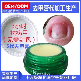 Tiktok explosion# onychomycosis nail remover OEM production and processing of nail remover nail remover nail remover beauty nail remover essential oil 8.31zs