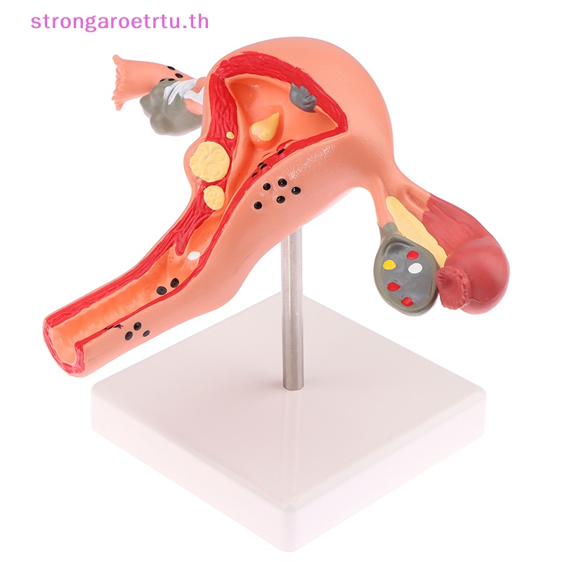 Strongaroetrtu อุปกรณ์ประกอบฉาก โมเดลมดลูก กายวิภาคศาสตร์ ไม้กางเขน 1 ชิ้น
