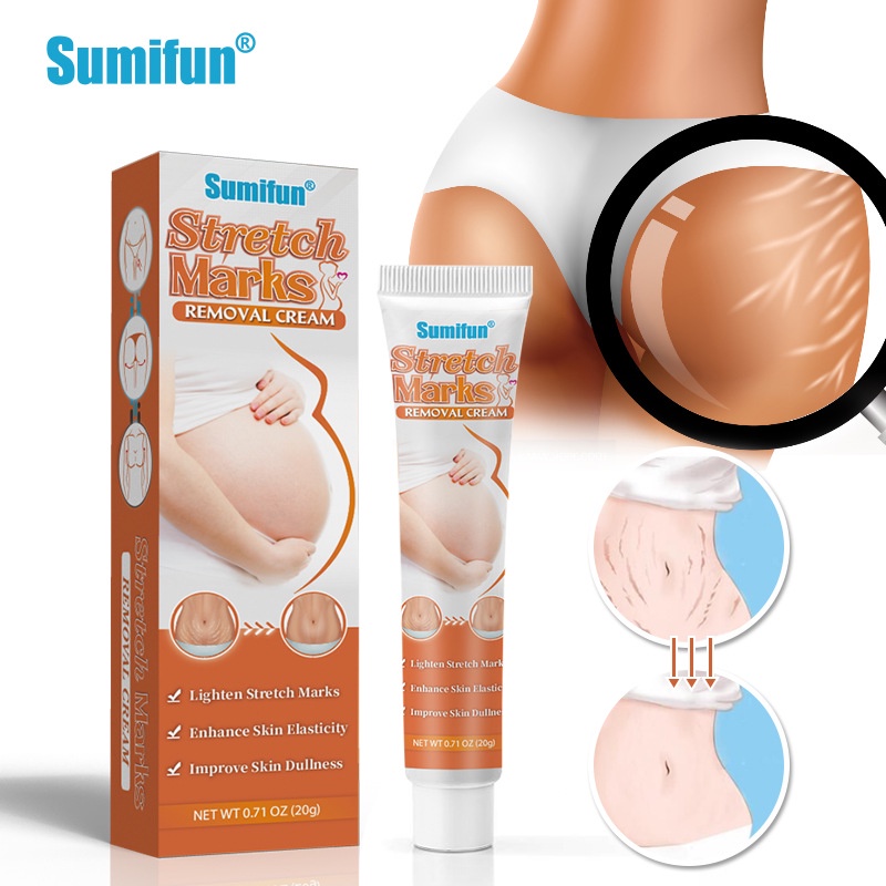 Hot Sale# Sumifun AliExpress Amazon cross-border stretch marks care cream scar care cream 20g K1007811 &amp;