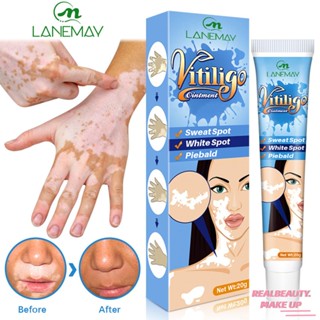 [COD] LANEMAY White Spot Cream Sweat Spot White Spot Skin Topical Cream Spot Care Repair Cream [realbeauty]