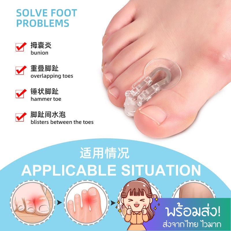 แยกนิ้วเท้า 1 คู่ นิ้วหัวแม่มือ valgus Corrector ตัวคั่นนิ้ว SC56