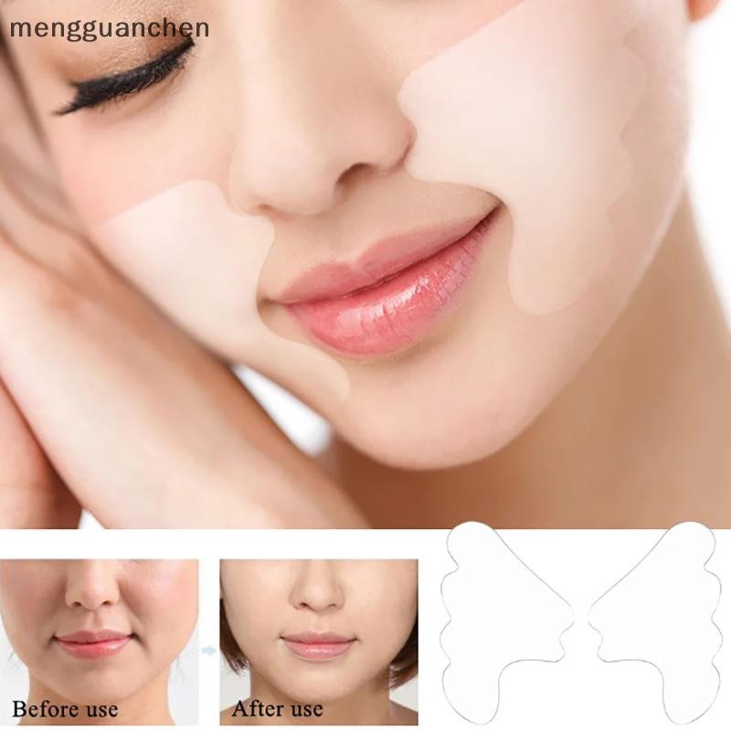 [mengguanchen] แผ่นกําจัดริ้วรอยบนใบหน้าซิลิโคนเกรดทางการแพทย์แบบใช้ซ้ําได้ Nasolabial พับหน้ากากต่อต้านริ้วรอยต่อต้านริ้วรอยยกกระชับผิวแพทช์ [TW]