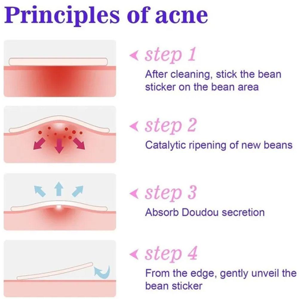 แผ่นแปะสิวไฮโดรคอลลอยด์ ลายการ์ตูนดอกไม้ หัวใจ ดาว น่ารัก - รูปที่ 4