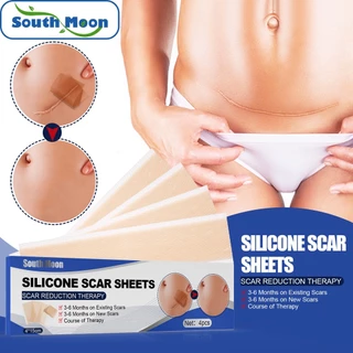 1pack South Moon แผ่นแปะแผลเป็น 4แผ่น/กล่อง แผ่นเจลซิลิโคน สําหรับซ่อมแซมรอยแผลเป็น