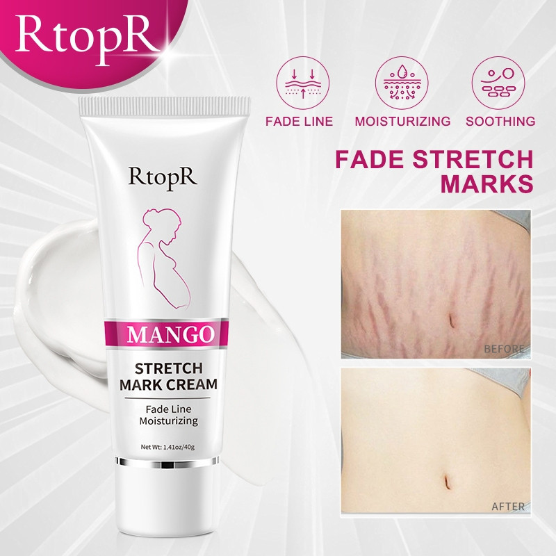RtopR Mango Stretch Mark Cream Anti-Winkles Firming Body Maternity Treatment (40g)