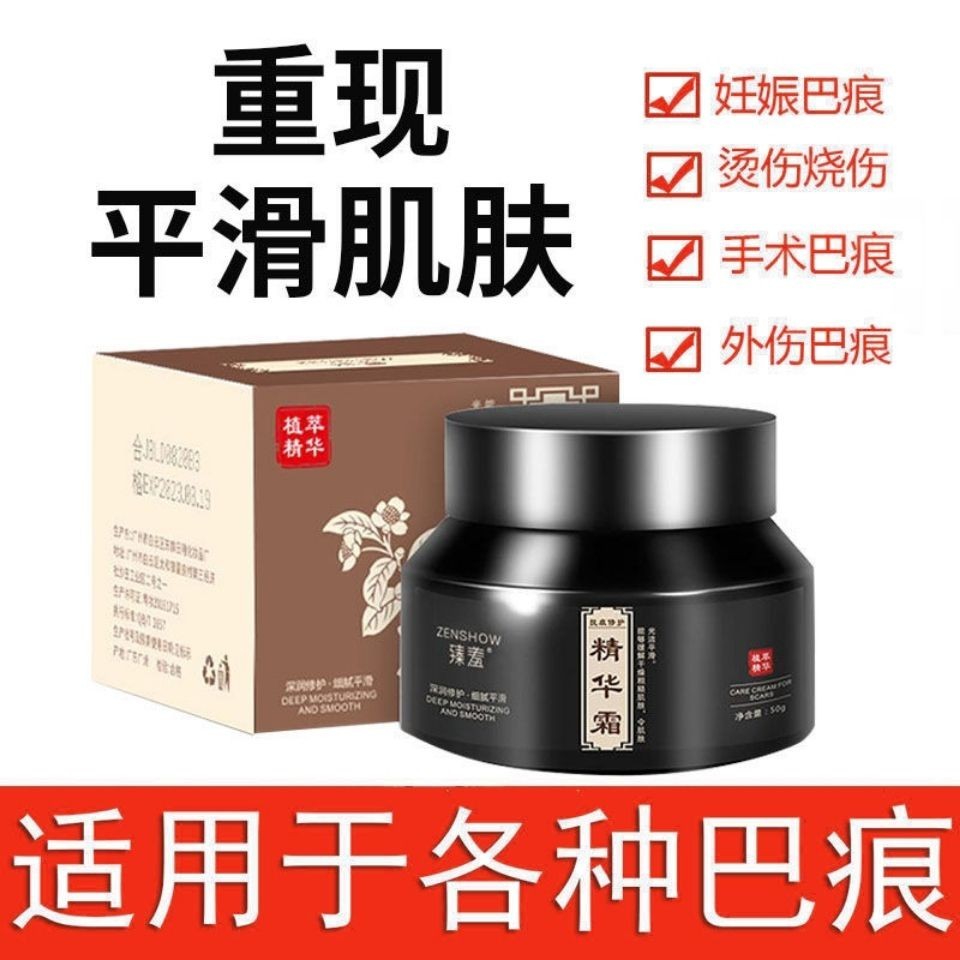 New Product#Scar Cream Scar Removal Old Scar Scar Light Mark Repair Concave-Convex Hyperplasia Acne Marks Acne Pit Scald Burn3wu