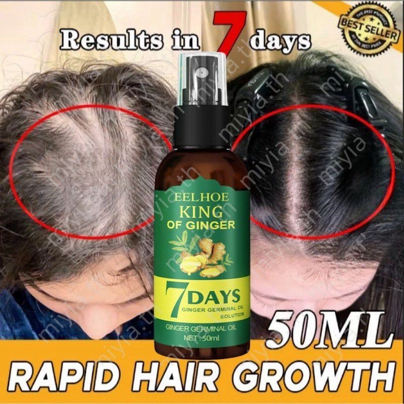 50ml Ginger Hair Growth Spray Serum Anti Hair Loss Fast Growing Germinal Liquid อินทรีย์ส่วนผสมธรรมชาติ Hair Regrowth miyia.th