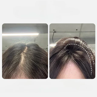 High Head Top Artifact หวีรากผมธรรมชาติปุยขี้เกียจ Traceless กิ๊บติดผมผม Fluffy Shaping Artifact