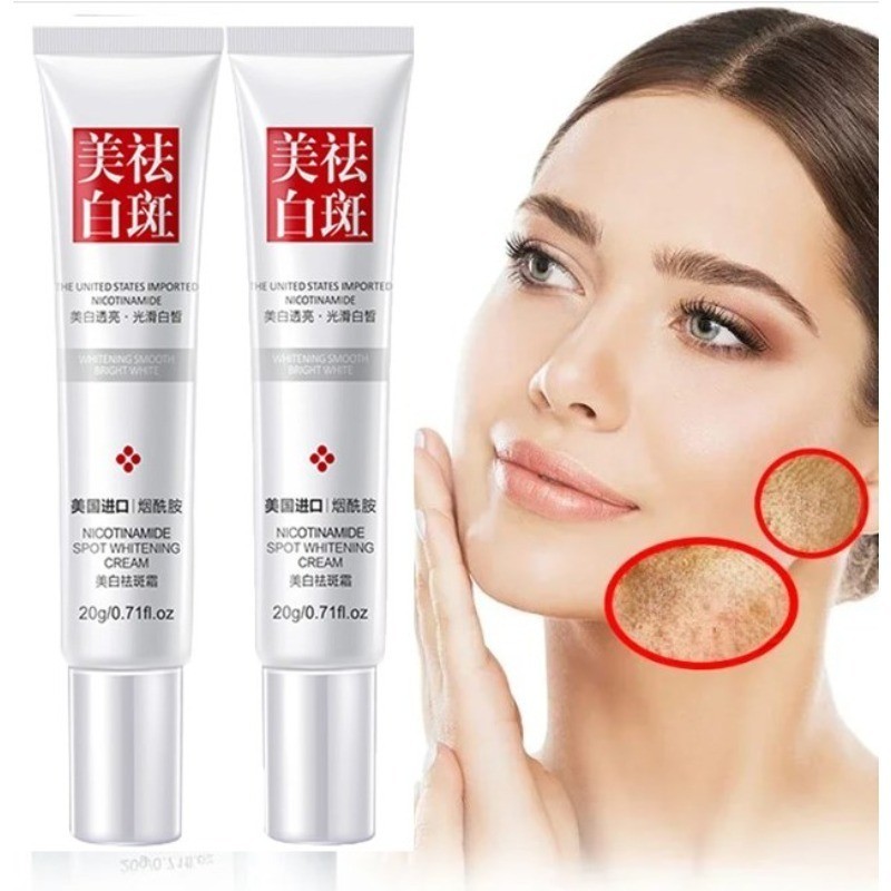 กระไวท์เทนนิ่งครีมจุดสีดํา Melasma Removal Anti Brown Stain Lighten Pigmentation Moisturizing Skin Care ผลิตภัณฑ์เกาหลี