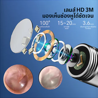 รูปแบบใหม่ NE3 Wireless อัจฉริยะ HD เด็กส่องกล้องหู, ทําความสะอาดหูโดยเฉพาะ ไม้แคะหูมีกล้อง พร้อมไฟ LED ชุดแคะหู กันน้ำ