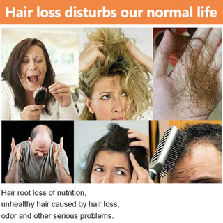 Te Hair Growth Essential Oil ไบโอตินสกัดเย็น DHT Blocker และแชมพูปลูกผม Anti-Hair Loss Conditioner