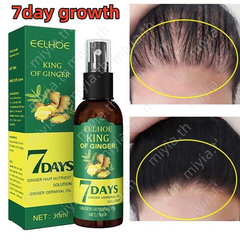 Eelhoe Hair Growth Ginger Spray Fast Hair Growth Essence ที่มีประสิทธิภาพส่วนผสมขิงธรรมชาติดูแลเส้นผมไม่มีผลข้างเคียง miyia.th