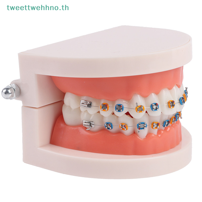 Tweettwehno โมเดลฟันจัดฟันพร ้ อมเหล ็ กจัดฟันอุปกรณ ์ การสอนโรงเรียน TH - รูปที่ 6