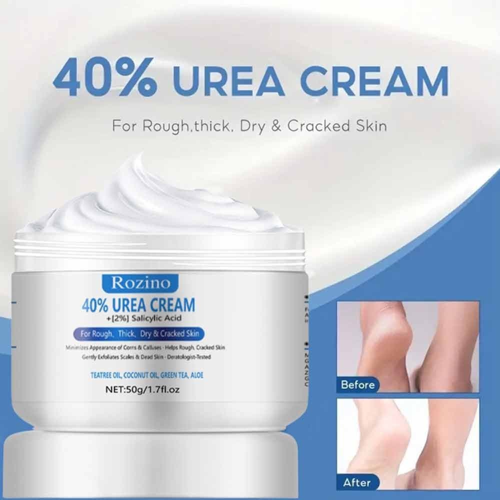 Urea Cream 40% Plus Salicylic Acid Intensive Moisturizes &amp; Softens Skin, Exfoliates Dead Skin
