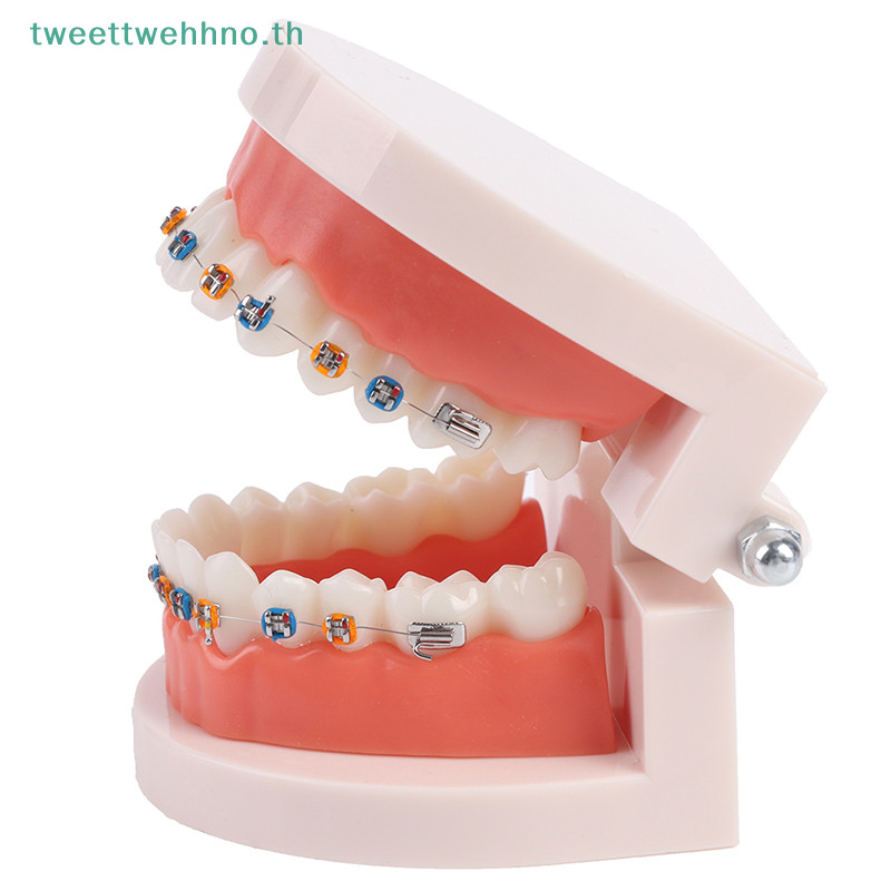 Tweettwehno โมเดลฟันจัดฟันพร ้ อมเหล ็ กจัดฟันอุปกรณ ์ การสอนโรงเรียน TH - รูปที่ 3