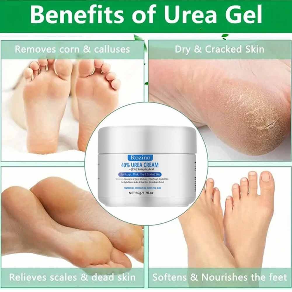 50g，Urea Cream 40% Plus Salicylic Acid Intensive Moisturizes &amp; Softens Skin, Exfoliates Dead Skin