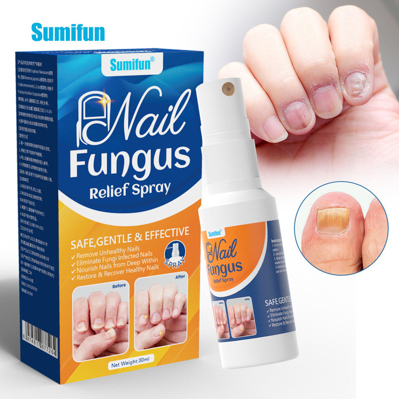 การรักษาเล็บ Essential Anti Fungal Infection Toe Hand Foot Skin Care 30ml สเปรย์บรรเทา
