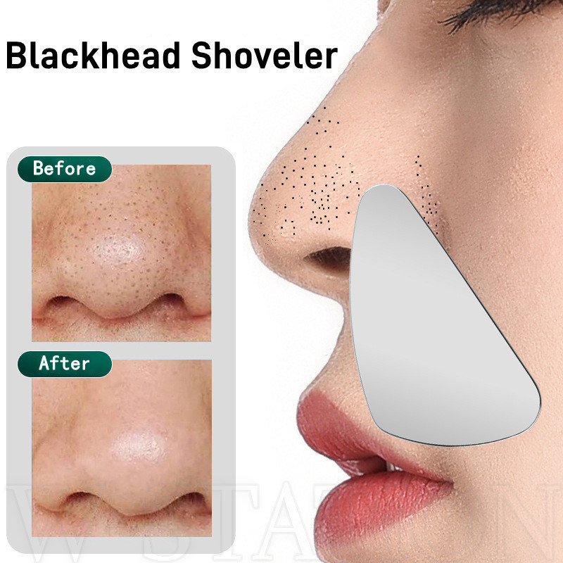 ที่ขูดสิวหัวดํา - เครื่องมือสกัดโลหะ - สําหรับสิว Comedone, สิวหัวดํา, สิวหัวขาว - บางพิเศษ, สแตนเลส, เครื่องมือขูดหน้า - เครื่องดูดสิวเสี้ยน