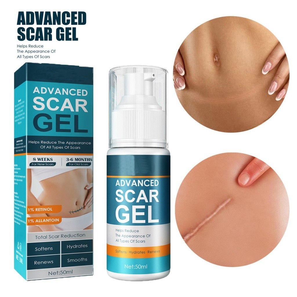 50ml Advanced Scar Cream Gel สําหรับทุกชนิดกําจัดรอยแผลเป ็ น Skin Care PM Intensive Overnight Scar Cream, Stretch Mark Cream, Scar Oil