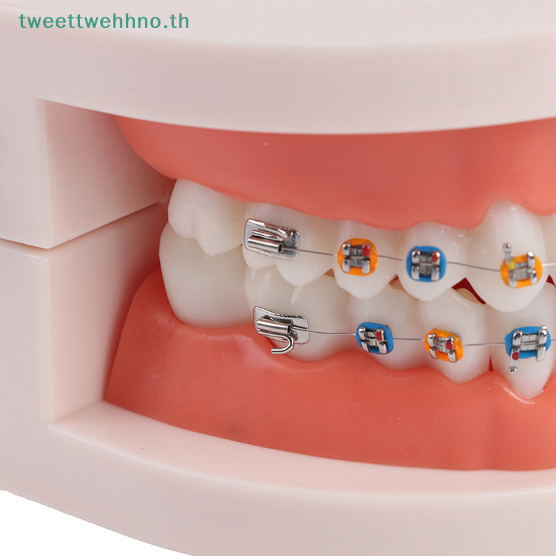 Tweettwehno โมเดลฟันจัดฟันพร ้ อมเหล ็ กจัดฟันอุปกรณ ์ การสอนโรงเรียน TH