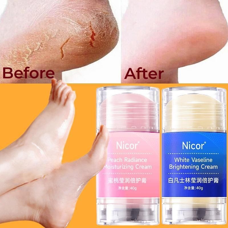 Foot &amp; Hand Cream Anti Crack Moisturizing Whitening Hand Heel Cream Skin Care สําหรับ WholeBody