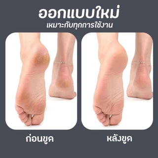 ตะไบขูดส้นเท้า ป้องกันเท้าแตก รุ่นใหม่ไฉไลกว่าเดิม ตะไบขัดเท้า ผลิตจากแสตนเลสแท้ พร้อมส่งจากไทย