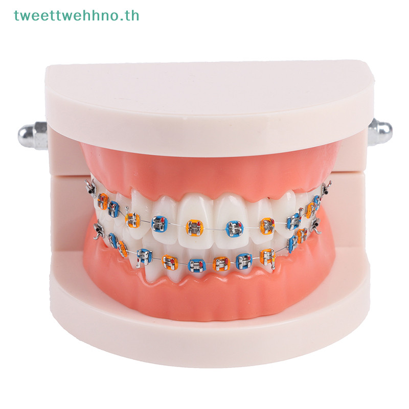 Tweettwehno โมเดลฟันจัดฟันพร ้ อมเหล ็ กจัดฟันอุปกรณ ์ การสอนโรงเรียน TH - รูปที่ 4