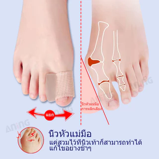 เส้นตรงนิ้วเท้าขนาดใหญ่รองรับตัวแยกนิ้วหัวแม่มือตัวแยกนิ้ว ตาปลา ผู้ดูแล ซิลิคอน เจล 1pc