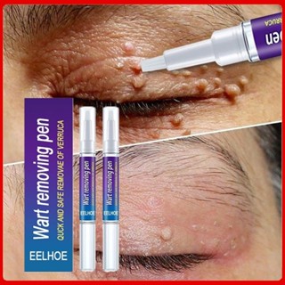 2 ชิ ้ น Wart Wart Remover ของเหลวกําจัดข ้ าวโพด