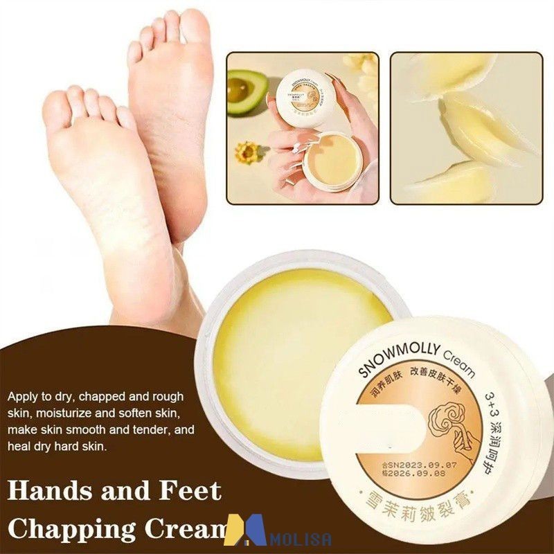 20g Anti-drying Crack Foot Cream Heel Cracked Repair ครีม Dead Skin Hand Feet Care MOLISA