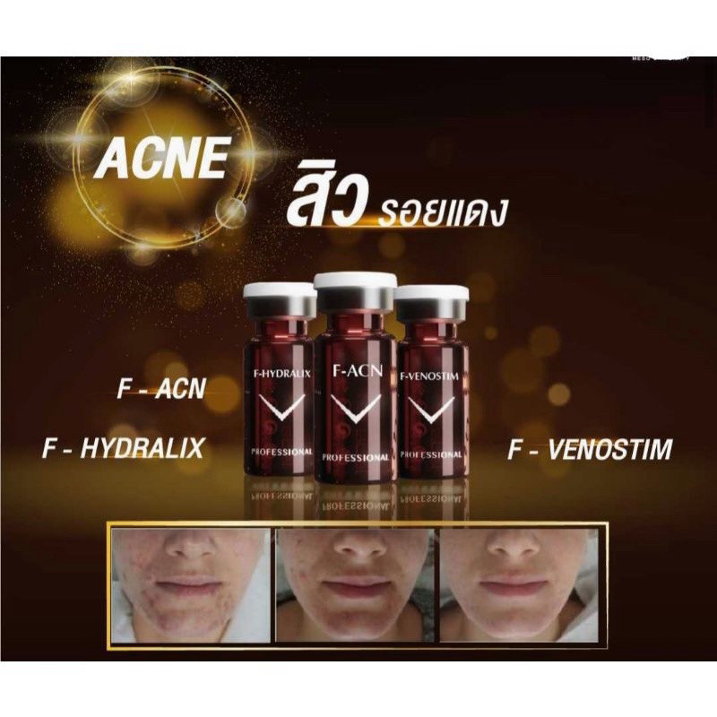 FUSION ACNE สิว รอยแดง 10 ml/ขวด