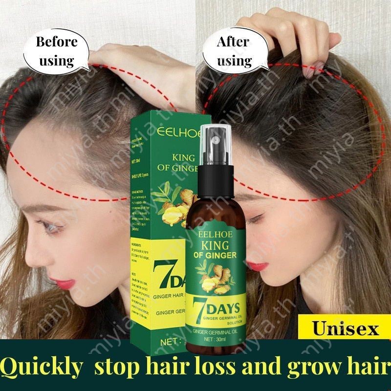 Ginger Hair Growth Spray Serum Anti Hair Loss Fast Growing Germinal Liquid อินทรีย์ส่วนผสมจากธรรมชาติ Hair Regrowth miyia.th