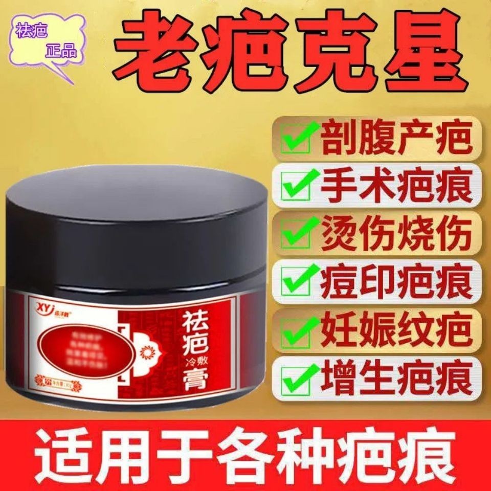 New Product#[Old Scar]Scar Removal Cream Fall Injury Scratch Scald Scar Repair Seamless Surgical Scar Stretch Marks Hyperplasia Scar3wu