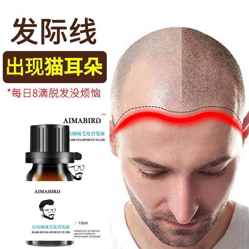 New Product#Fast Hairline Hair Growth Liquid Hair Growth Tonic Anti-off Hair Care Agent Hair Thickening Essence Artifact for Male and Female Students2wu