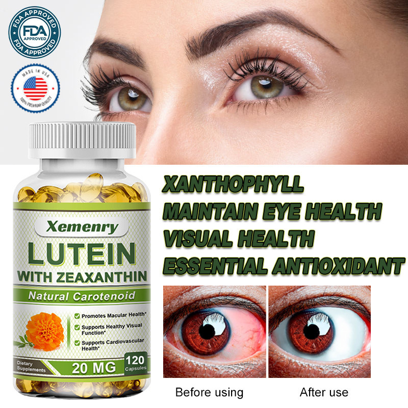 Natural Vision Support Lutein 20 มก. - บรรเทาความเมื่อยล้าของดวงตา, ​​ป้องกันแสงสีฟ้า, สุขภาพจอประสาทตา