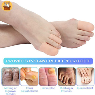 【Am-az】ปลอกซิลิโคนสวมนิ้วเท้า บรรเทาอาการปวดตาปลา 1 คู่