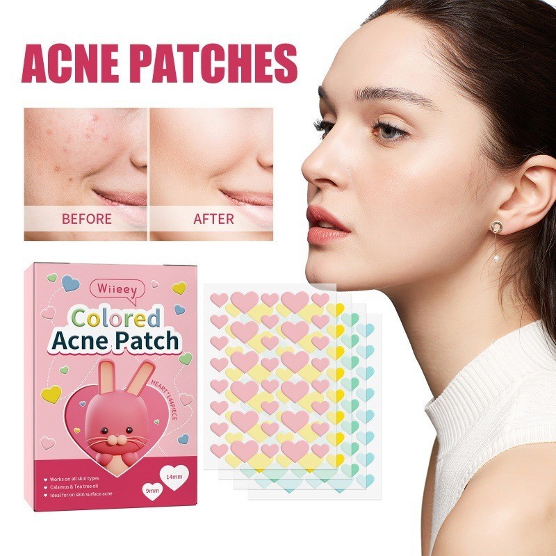 144pcs น่ารัก Star Cloud Love Moon กันน้ําสิว Patch Remover Blemish Treatment Skin Care สิวซ่อม Oxy สิวสิว Clear Fit Master Patch