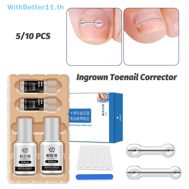 Better คุด Toenail Corrector เครื่องมือ Pedicure Recovered Toe Nail Treatment คุด Toenail Straightening คลิปรั้ง TH - รูปที่ 6