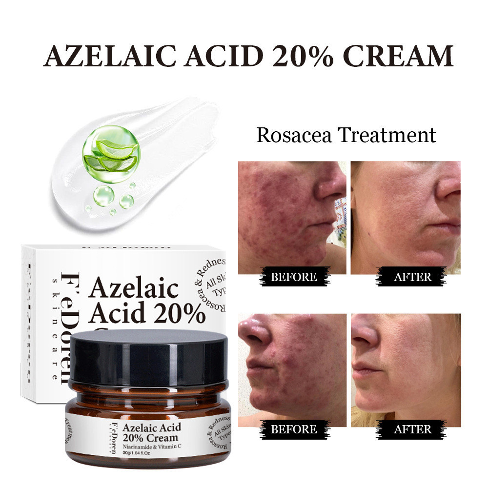 ครีมกรด Azelaic 20 % Azelaic Acid Serum Cream,Face Serum Skin Care Beauty พร ้ อม Niacinamide และวิต