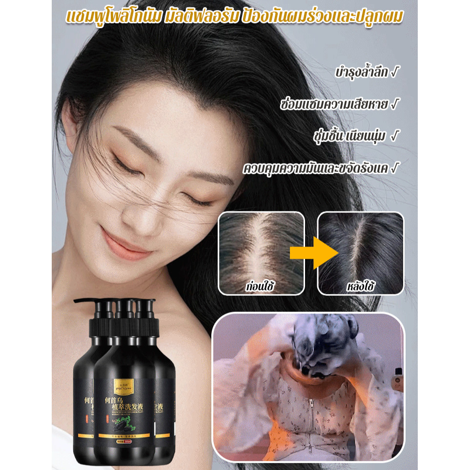 แชมพูสมุนไพรพฤกษศาสตร ์ ควบคุมความมัน AntiItch AntiDandruff He Shouwu