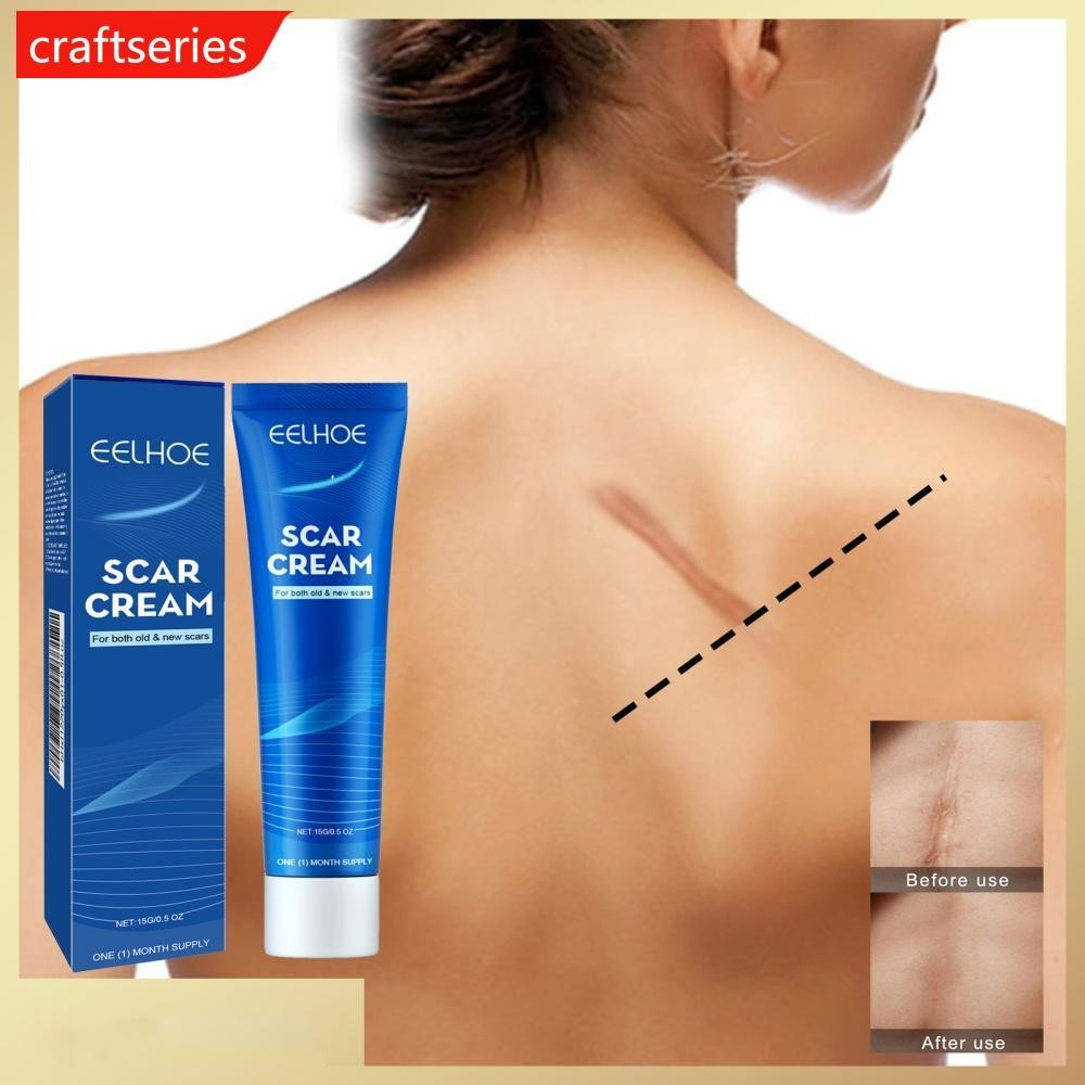 Craftseries Skin Repair Cream Scar Cream Care สําหรับ Scalds Burn Marks Acne Marks Fading and Smoothing Care Cream ครีมแผลเป ็ น H3N5