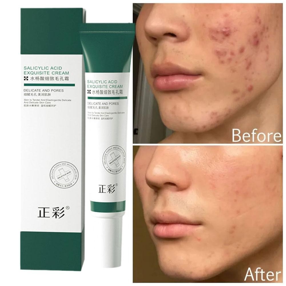 Salicylic Acid Pore Reinning Cream Firming Collagen Care Essence Skin 20g Whitening Facial N2L3