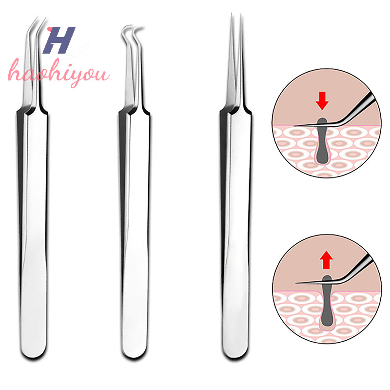 <haohiyou> 8 ซม.เซลล์สิว Blackhead คลิปแหนบร้านเสริมสวยพิเศษขูดปิด Artifact สิวเครื่องมือ Nice