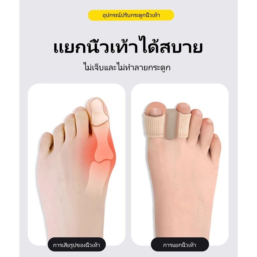 ตัวแก้ไขนิ้วเท้าเอียง, ตัวแยกนิ้วเท้า, นิ้วโป้งเท้าผิดรูปทับกัน ตัวแยกใยซิลิโคนที่สวมรองเท้าได้