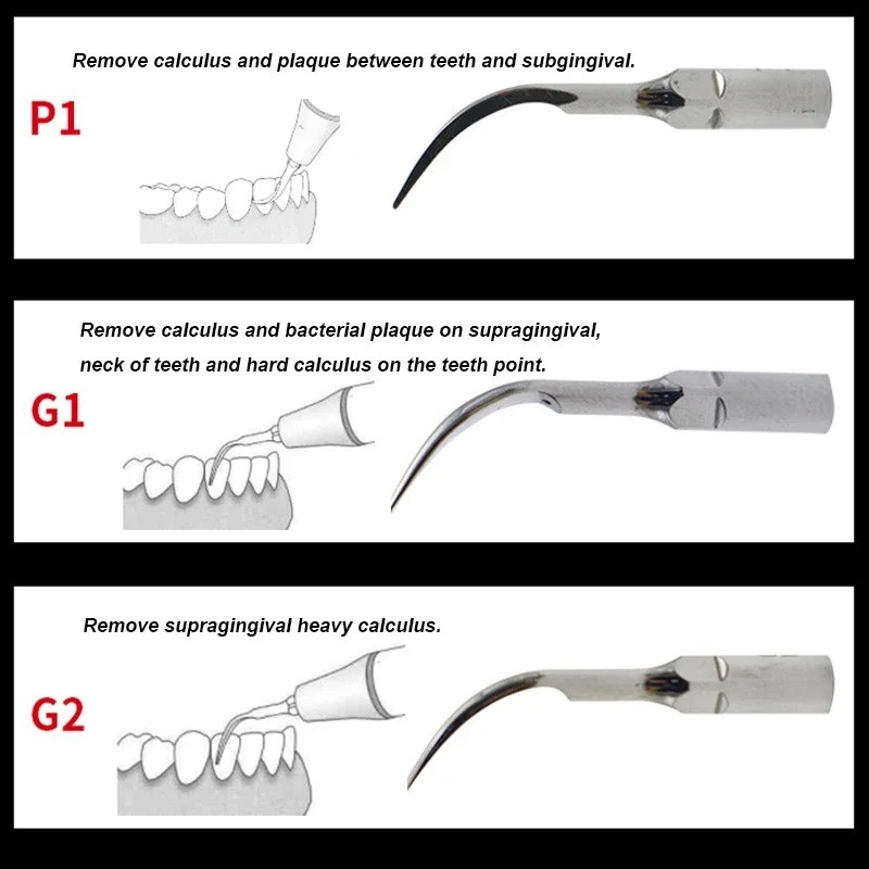 Niceden 5 ชิ้น/แพ็คทันตกรรมนกหัวขวาน G1 G2 G4 P1 Ultrasonic Scaler Scaling เคล็ดลับมือชิ้นไม้-Pecker ทํางานสําหรับทําความสะอาด - รูปที่ 3