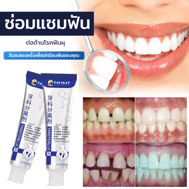 [สำหรับทันตกรรม] ยาสีฟันทางการแพทย์ซ่อมแซมฟัน ทันตกรรมทำความสะอาดฟันแยกยาสีฟันทันตกรรม