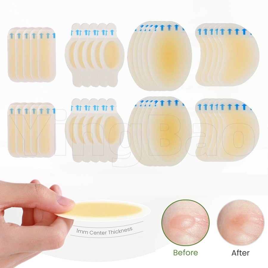 20 ชิ้น Blister พลาสเตอร์ที่มองไม่เห็น Hydrocolloid Gel Blister Bandages Blister Cushion Pad สําหรับส้นเท้า Toe และ Guard ผิว
