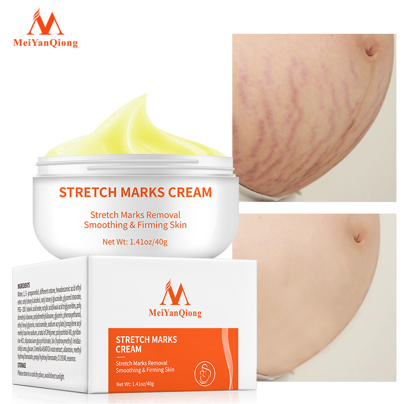 MeiYanQiong High Quality Smooth Skin Cream For Stretch Marks Scar Removal To Maternity Skin Repair Body Cream